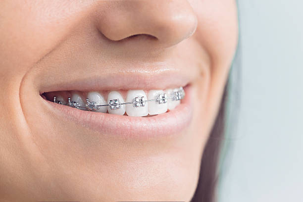 Best Veneers and Lumineers  in Bridgeview, IL